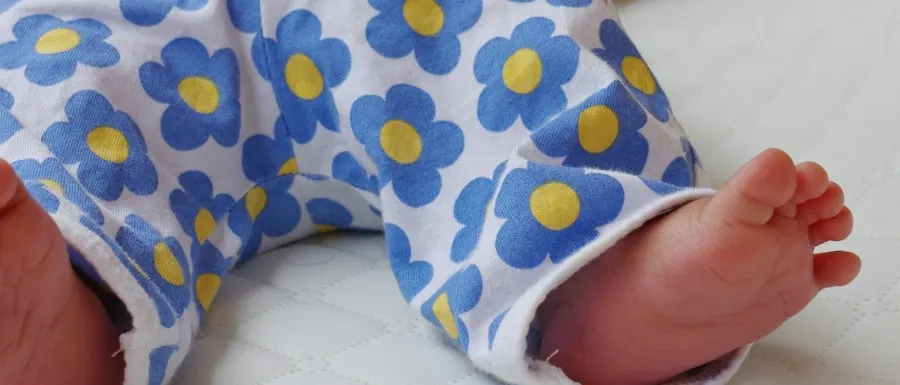 Little Star Yellow Baby Romper - Easy Wear for Busy Kids